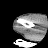 SPORK, NICO - 22.03.1976 - 02.08.2022 - CT obere Extremität - 17:51:17